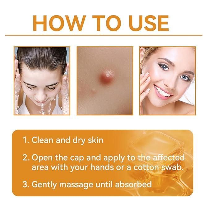 Bee Venom Skin Treatment Cream (Pack of 2)