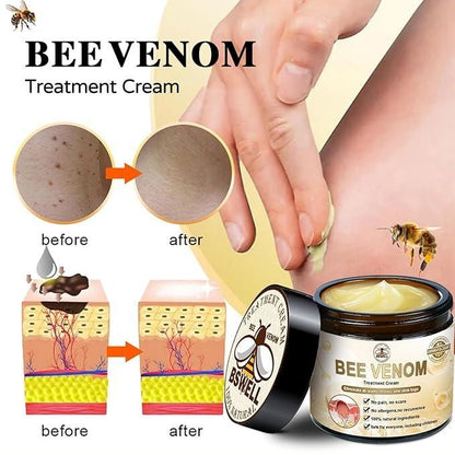 Bee Venom Skin Treatment Cream (Pack of 2)